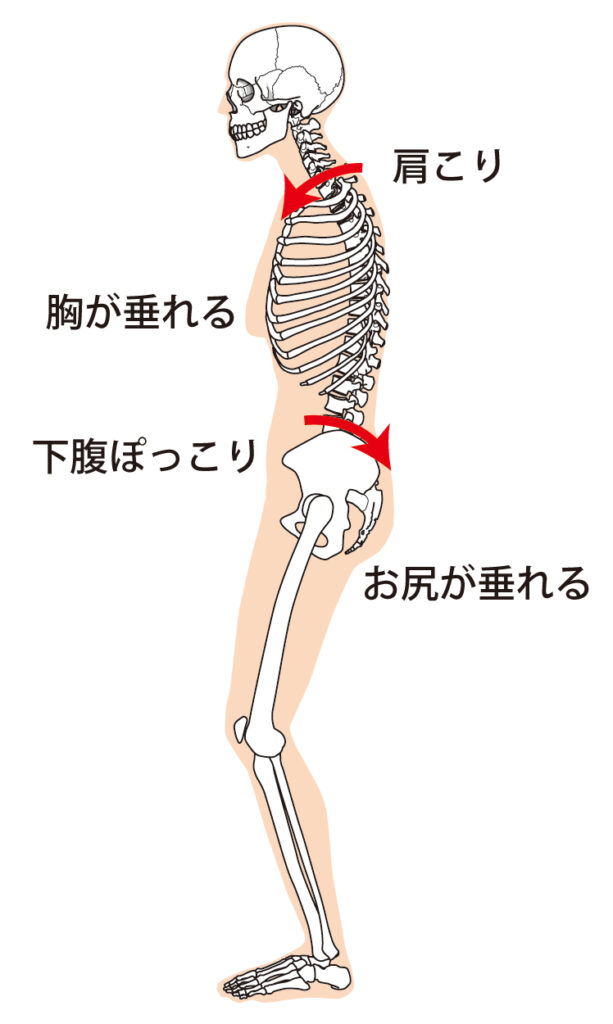 姿勢の崩れが肩こり・下腹ぽっこり・お尻の垂れなど全身の不調につながることを示したイラスト