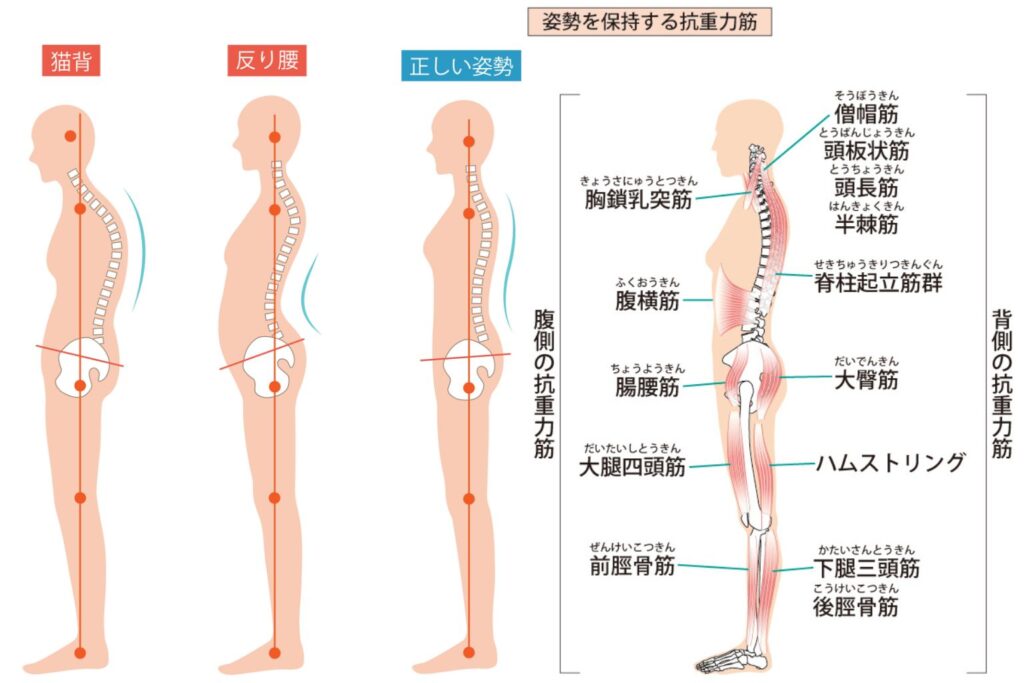 猫背・反り腰・正しい姿勢の違いと、姿勢を支える抗重力筋（脊柱起立筋・腹横筋・腸腰筋・大臀筋・ハムストリングなど）の位置を解説した姿勢バランスの図